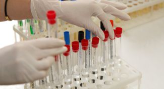 Картинка по теме - как сдавать эстрадиол