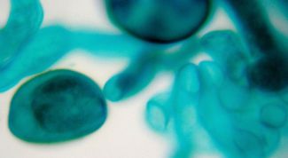 Картинка по теме - что такое гомозигота