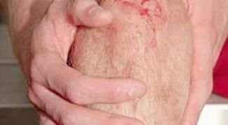 Картинка по теме - почему болят колени