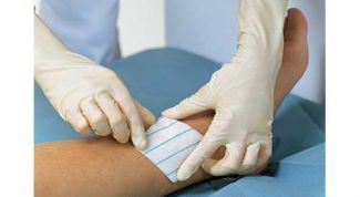 Картинка по теме - как обрабатывать рваные раны