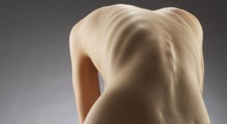 Картинка по теме - как избавиться от анорексии