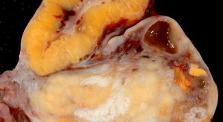 Картинка по теме - что такое желтое тело