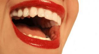 Картинка по теме - как отбелить пломбу