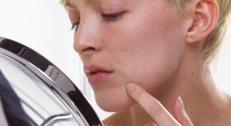 Картинка по теме - как избавиться от прыщей и угревой сыпи