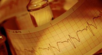 Картинка по теме - что такое тахикардия