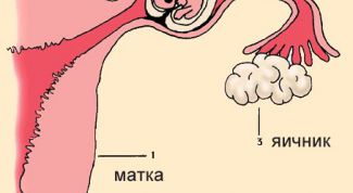 Картинка по теме - что делать при внематочной беременности