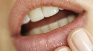 Картинка по теме - как избавиться от следов герпеса