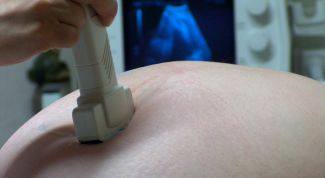 Картинка по теме - как определить угрозу выкидыша