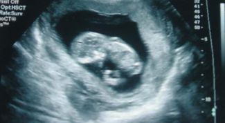 Картинка по теме - как определить размер плода