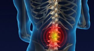 Картинка по теме - как лечить позвонковые грыжи