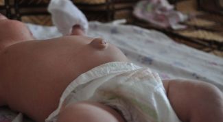 Картинка по теме - как заклеивать пупочную грыжу