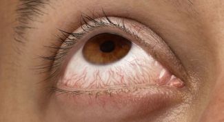 Картинка по теме - почему лопаются капилляры в глазах