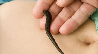 Картинка по теме - как остановить кровь после пиявок