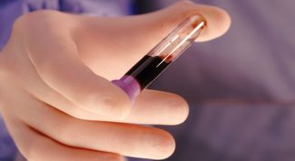 Картинка по теме - как распознать атеросклероз сосудов