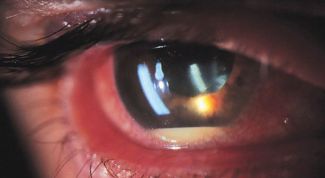 Картинка по теме - почему белок глаза красный