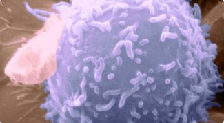 Картинка по теме - как повысить уровень лимфоцитов