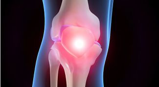 Картинка по теме - как лечить кисту сустава