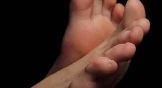 Картинка по теме - что делать с вросшим ногтем на ноге