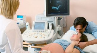 Картинка по теме - как выявить синдром дауна