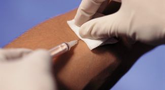 Картинка по теме - как лечить келоидный рубец