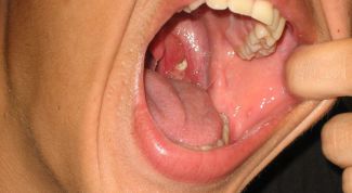 Картинка по теме - для чего нужны миндалины