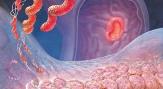 Картинка по теме - как выявить симптомы гастрита 