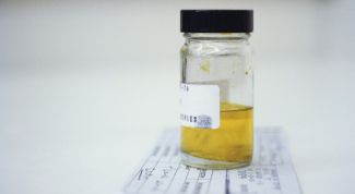 Картинка по теме - как собрать мочу для анализа на стерильность