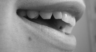 Картинка по теме - почему портятся зубы
