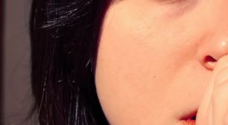 Картинка по теме - почему появляется герпес