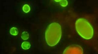 Картинка по теме - почему появляется киста