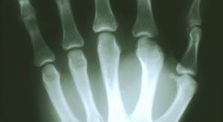 Картинка по теме - почему хрустят суставы