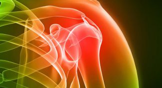 Картинка по теме - что делать при артрите суставов