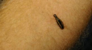 Картинка по теме - как использовать пиявки