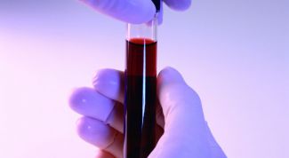 Картинка по теме - что нужно для сдачи крови