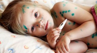 Картинка по теме - как выявить симптомы ветрянки