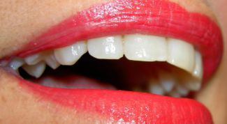 Картинка по теме - как удалить зубной налет