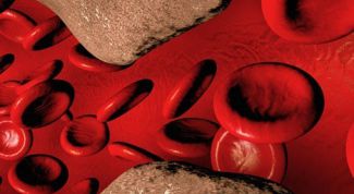 Картинка по теме - как определить симптомы атеросклероза сосудов