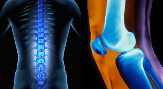 Картинка по теме - как лечить артрит суставов народными средствами