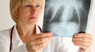 Картинка по теме - как распознать симптомы бронхита