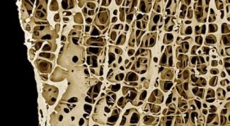Картинка по теме - как восстановить костную ткань