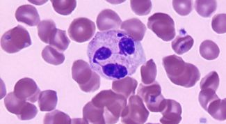 Картинка по теме - как снизить количество лейкоцитов