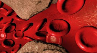 Картинка по теме - как проявляется атеросклероз сосудов