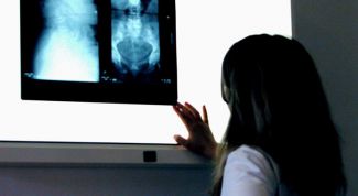 Картинка по теме - что способствует образованию злокачественной опухоли