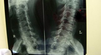 Картинка по теме - как делать рентген позвоночника