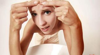 Картинка по теме - как избавиться от угрей на лбу