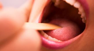 Картинка по теме - как лечить пробки на миндалинах