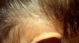 Картинка по теме - как найти вшей