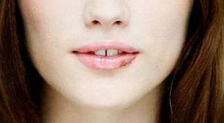 Картинка по теме - как излечиться от герпеса