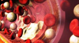 Картинка по теме - как избавиться от бляшек в сосудах