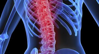 Картинка по теме - как устранить искривление позвоночника